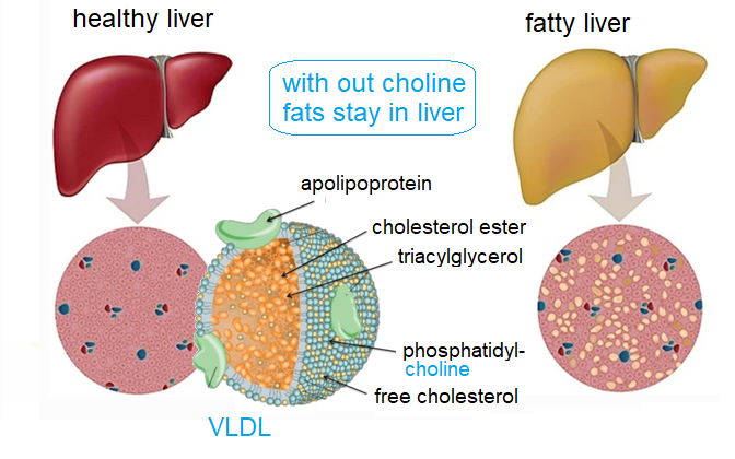 Fatty Liver Disease