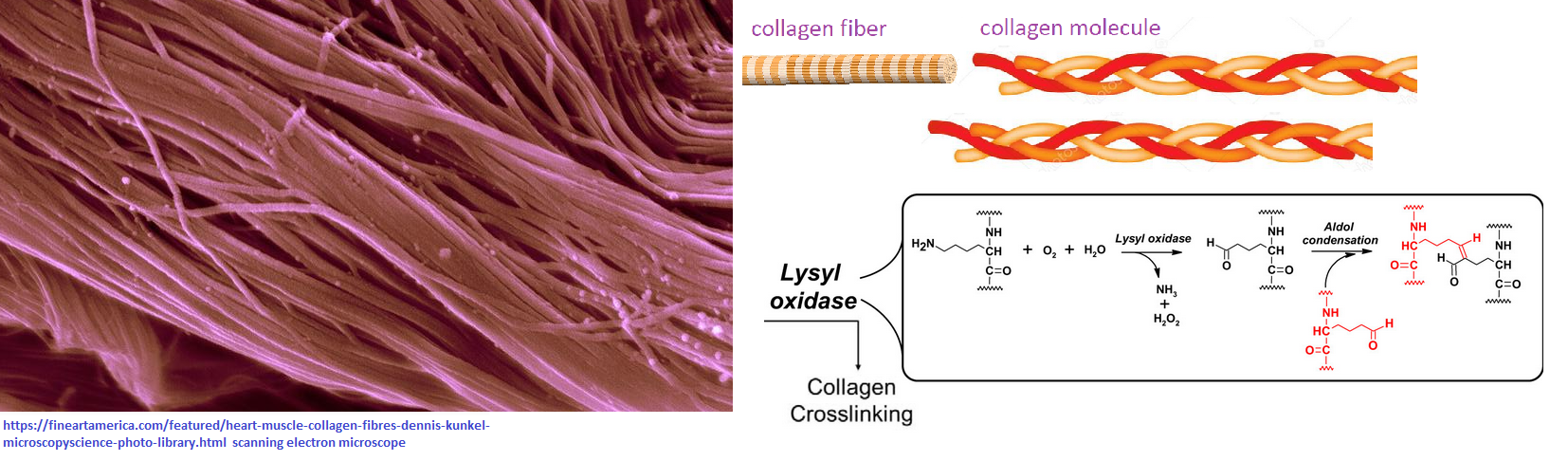 Copper and heart disease